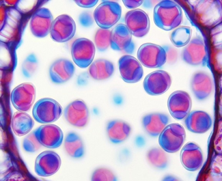 hd2500T_cell_slide
